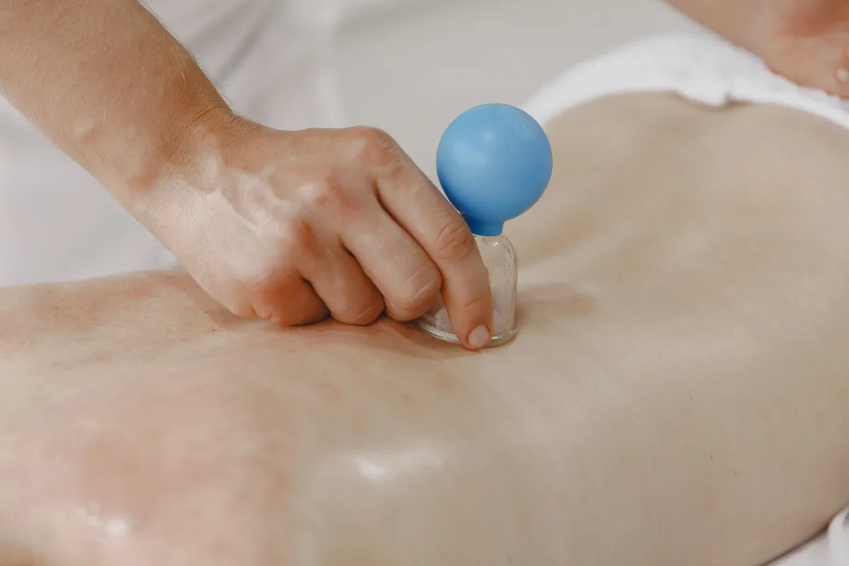 Suction cup used during dry cupping